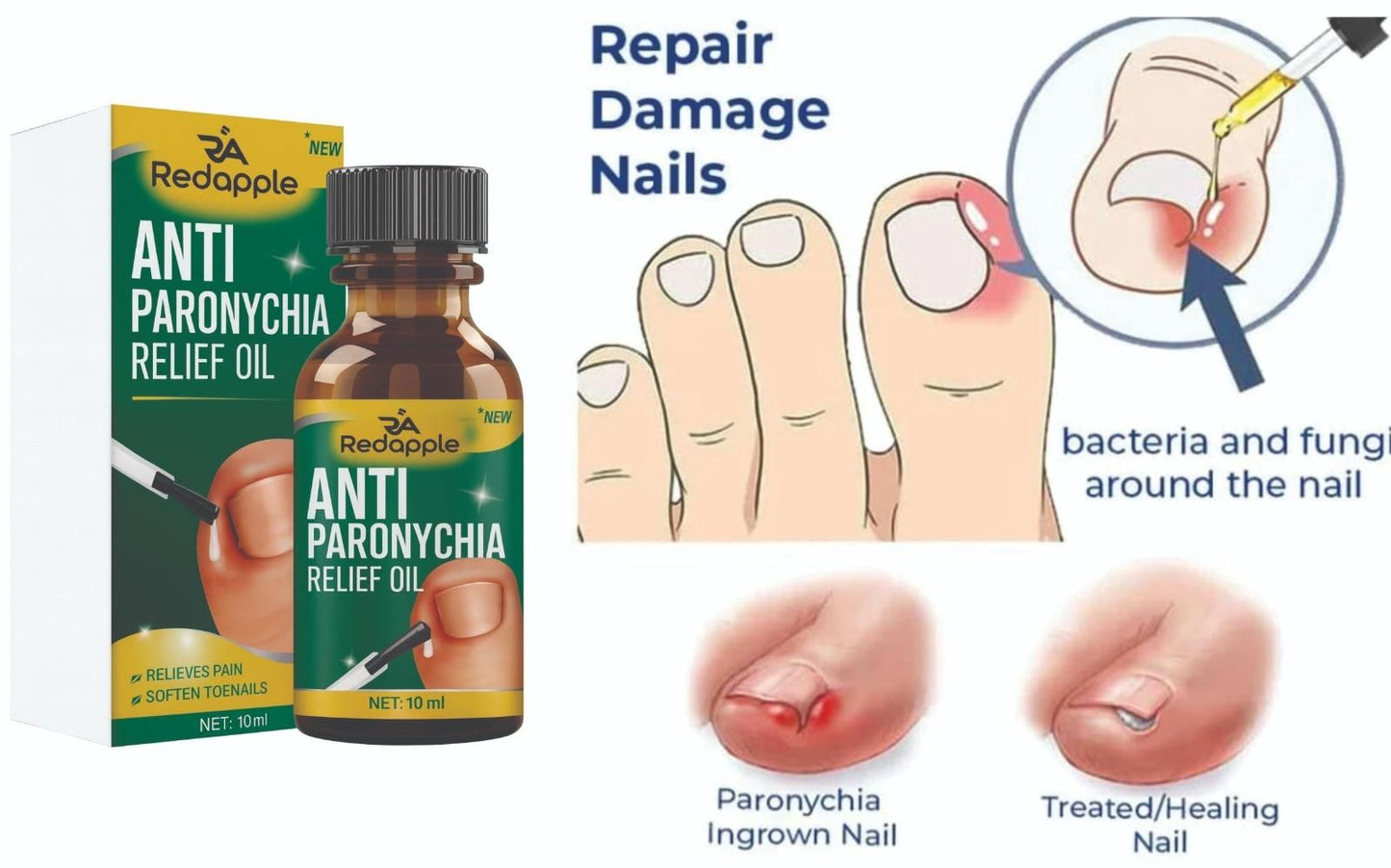 Nails repair & Anti Paronychia Relief Oil 20 ml Pack of 2