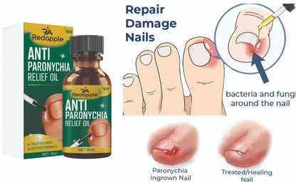 Nails repair & Anti Paronychia Relief Oil 20 ml Pack of 2