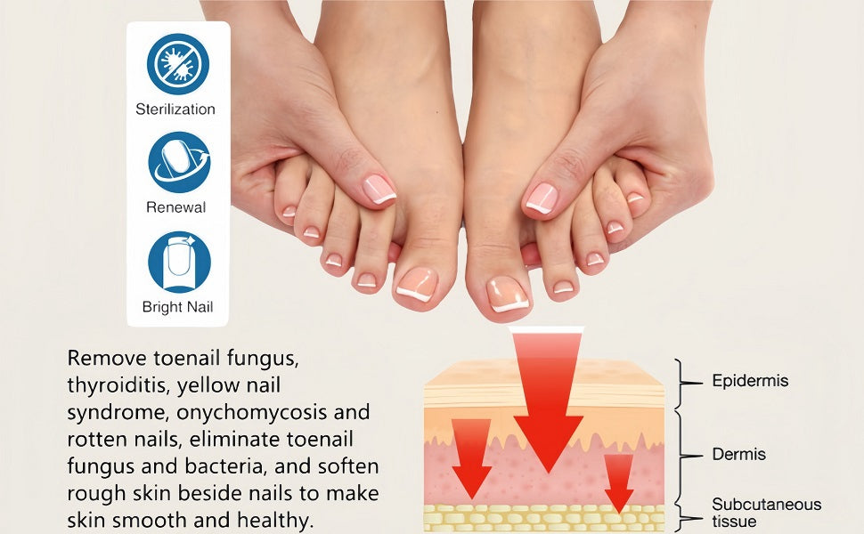 Nail Treatment Fungal Nail Patches (Pack of 2)