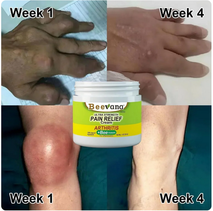 Bee Venom Joint and Bone Therapy Cream (Pack of 3)