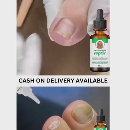 Nails Strong Growth And Repair Oli ( Pack Of 2)